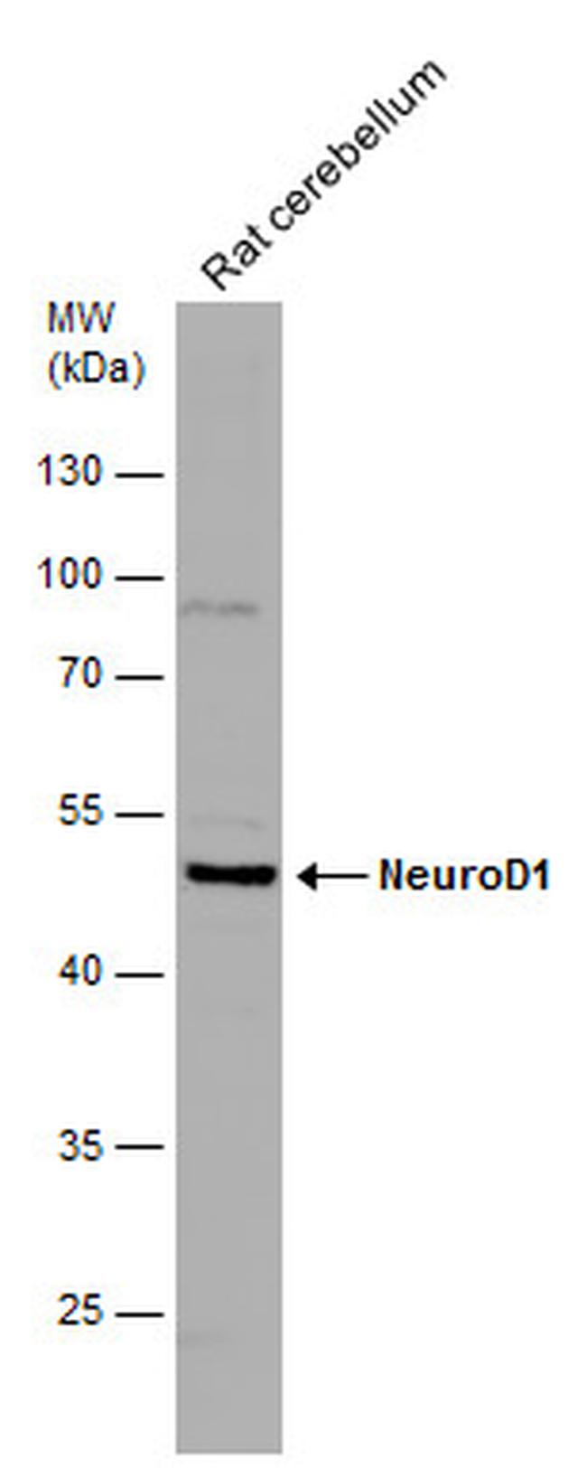 NeuroD1 Antibody in Western Blot (WB)