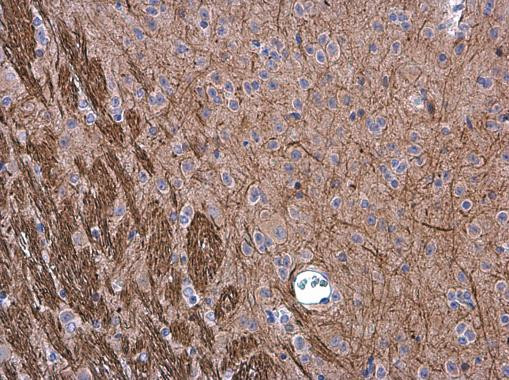 NEFM Antibody in Immunohistochemistry (Paraffin) (IHC (P))