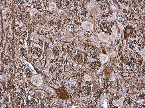 NEFM Antibody in Immunohistochemistry (Paraffin) (IHC (P))