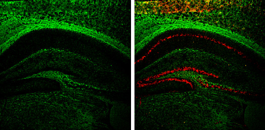 NEFM Antibody in Immunohistochemistry (Frozen) (IHC (F))