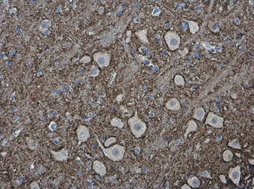 VAMP2 Antibody in Immunohistochemistry (Paraffin) (IHC (P))