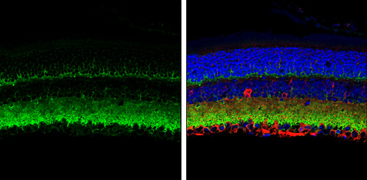 VAMP2 Antibody in Immunohistochemistry (Paraffin) (IHC (P))