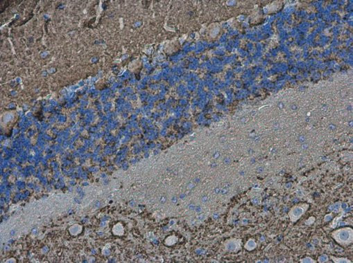 VAMP2 Antibody in Immunohistochemistry (Paraffin) (IHC (P))