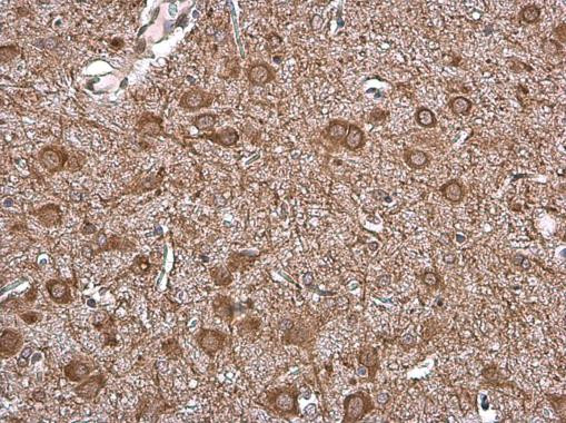 VAChT Antibody in Immunohistochemistry (Paraffin) (IHC (P))