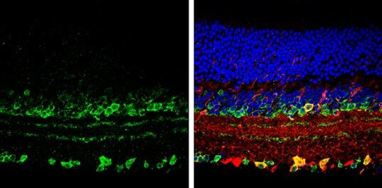 VAChT Antibody in Immunohistochemistry (Paraffin) (IHC (P))