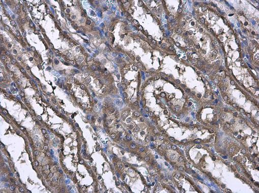 CASK Antibody in Immunohistochemistry (Paraffin) (IHC (P))