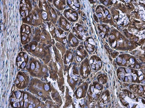 CASK Antibody in Immunohistochemistry (Paraffin) (IHC (P))