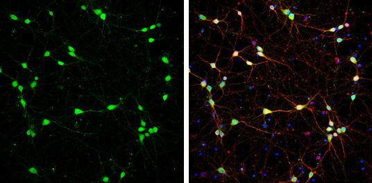 DARPP-32 Antibody in Immunocytochemistry (ICC/IF)