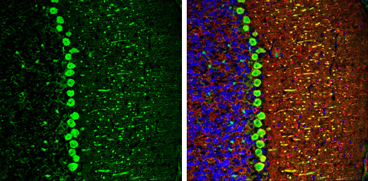 DARPP-32 Antibody in Immunohistochemistry (Frozen) (IHC (F))