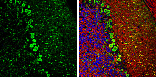 DARPP-32 Antibody in Immunohistochemistry (Frozen) (IHC (F))