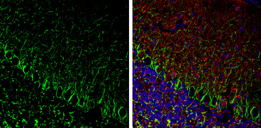 alpha Internexin Antibody in Immunohistochemistry (Frozen) (IHC (F))