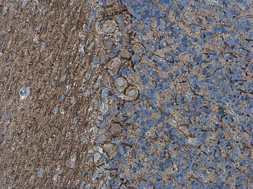 alpha Internexin Antibody in Immunohistochemistry (Paraffin) (IHC (P))