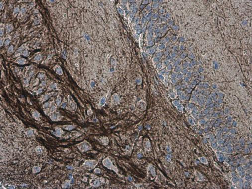 alpha Internexin Antibody in Immunohistochemistry (Paraffin) (IHC (P))