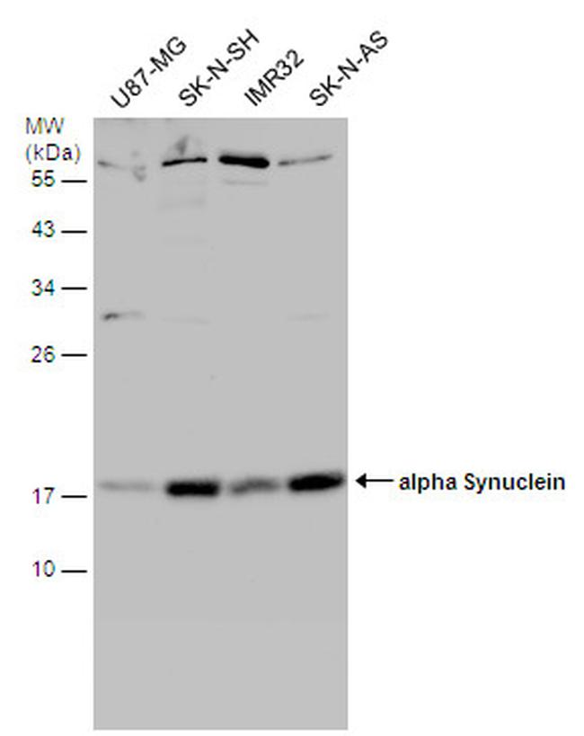 alpha Synuclein Antibody in Western Blot (WB)