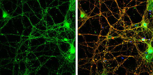 alpha Synuclein Antibody in Immunocytochemistry (ICC/IF)