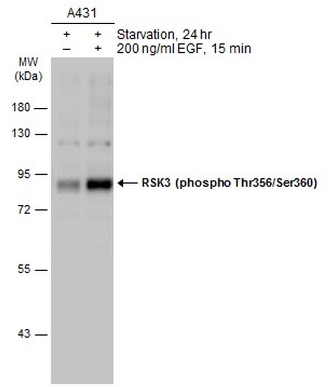 Phospho-RSK3 (Thr356, Ser360) Antibody in Western Blot (WB)