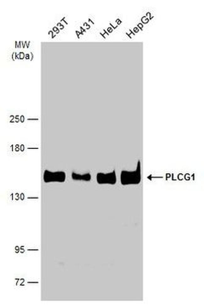 PLCG1 Antibody in Western Blot (WB)