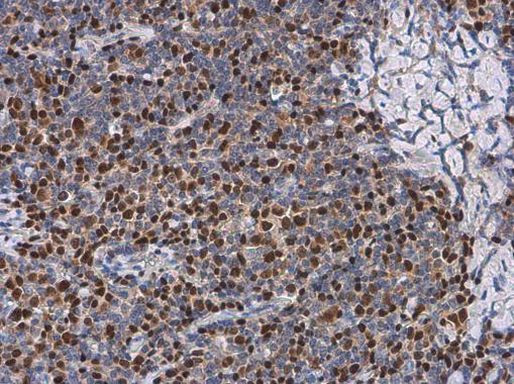 PAX5 Antibody in Immunohistochemistry (Paraffin) (IHC (P))