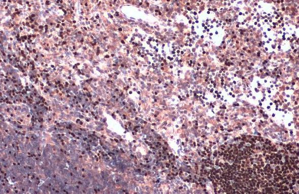 PAX5 Antibody in Immunohistochemistry (Paraffin) (IHC (P))