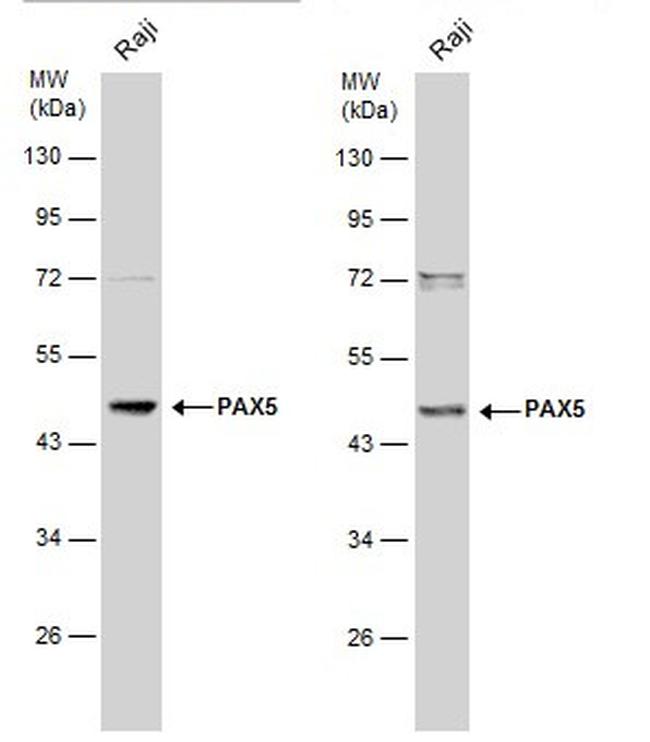 PAX5 Antibody in Western Blot (WB)