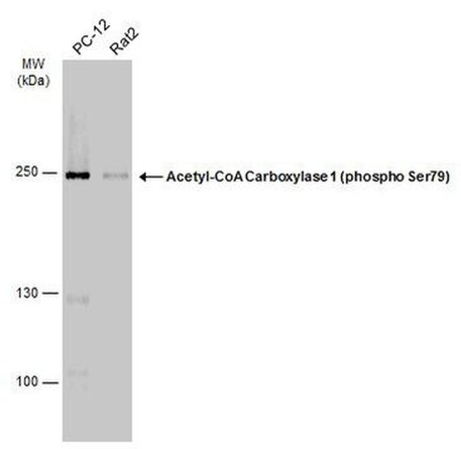 Phospho-Acetyl-CoA Carboxylase (Ser79) Antibody in Western Blot (WB)