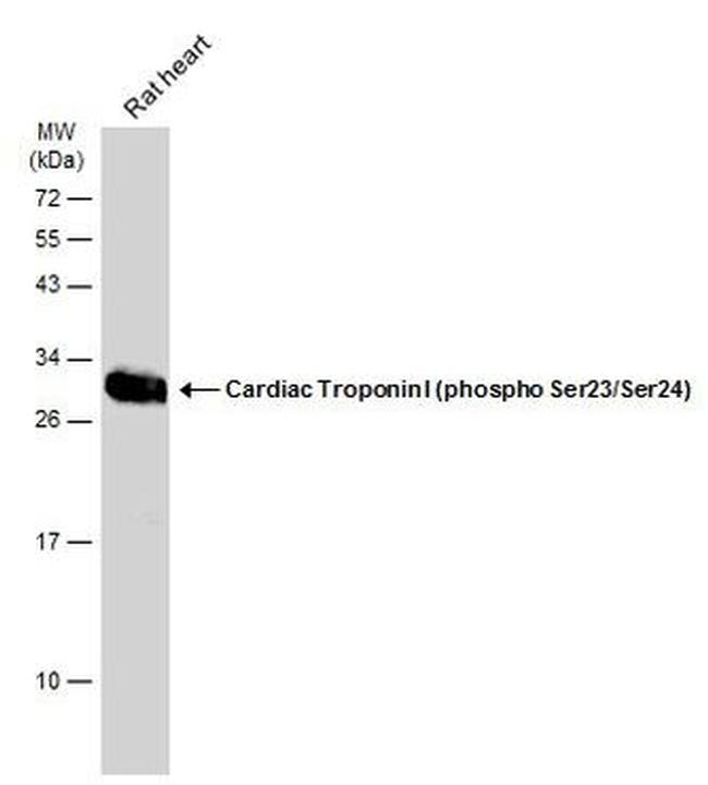 Phospho-Cardiac Troponin I (Ser23, Ser24) Antibody in Western Blot (WB)