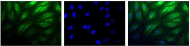 HIF-2 alpha Antibody in Immunocytochemistry (ICC/IF)