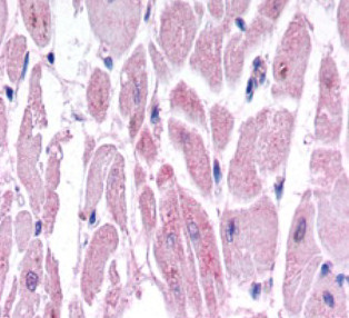 HIF-2 alpha Antibody in Immunohistochemistry (IHC)