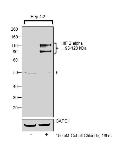 HIF-2 alpha Antibody in Western Blot (WB)