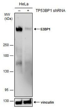 53BP1 Antibody