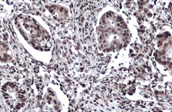 53BP1 Antibody in Immunohistochemistry (Paraffin) (IHC (P))