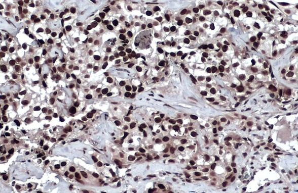 53BP1 Antibody in Immunohistochemistry (Paraffin) (IHC (P))