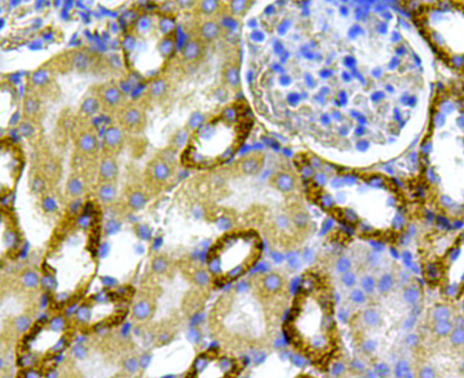 CD171 (L1CAM) Antibody in Immunohistochemistry (Paraffin) (IHC (P))
