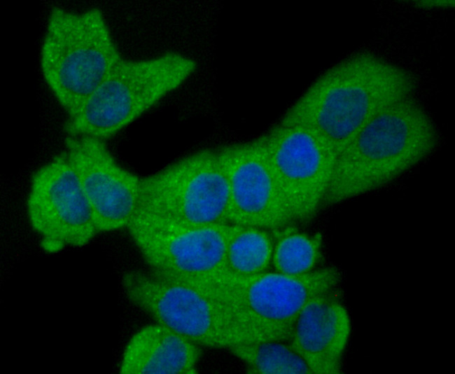 CD62E (E-selectin) Antibody in Immunocytochemistry (ICC/IF)