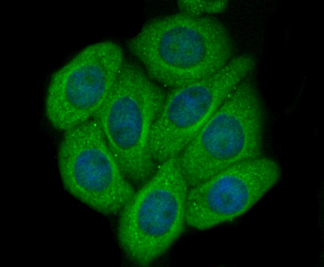 CD62E (E-selectin) Antibody in Immunocytochemistry (ICC/IF)