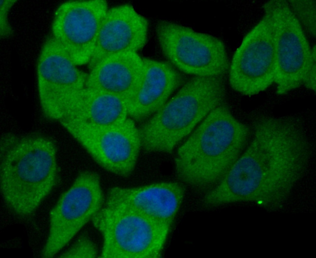 CD62E (E-selectin) Antibody in Immunocytochemistry (ICC/IF)