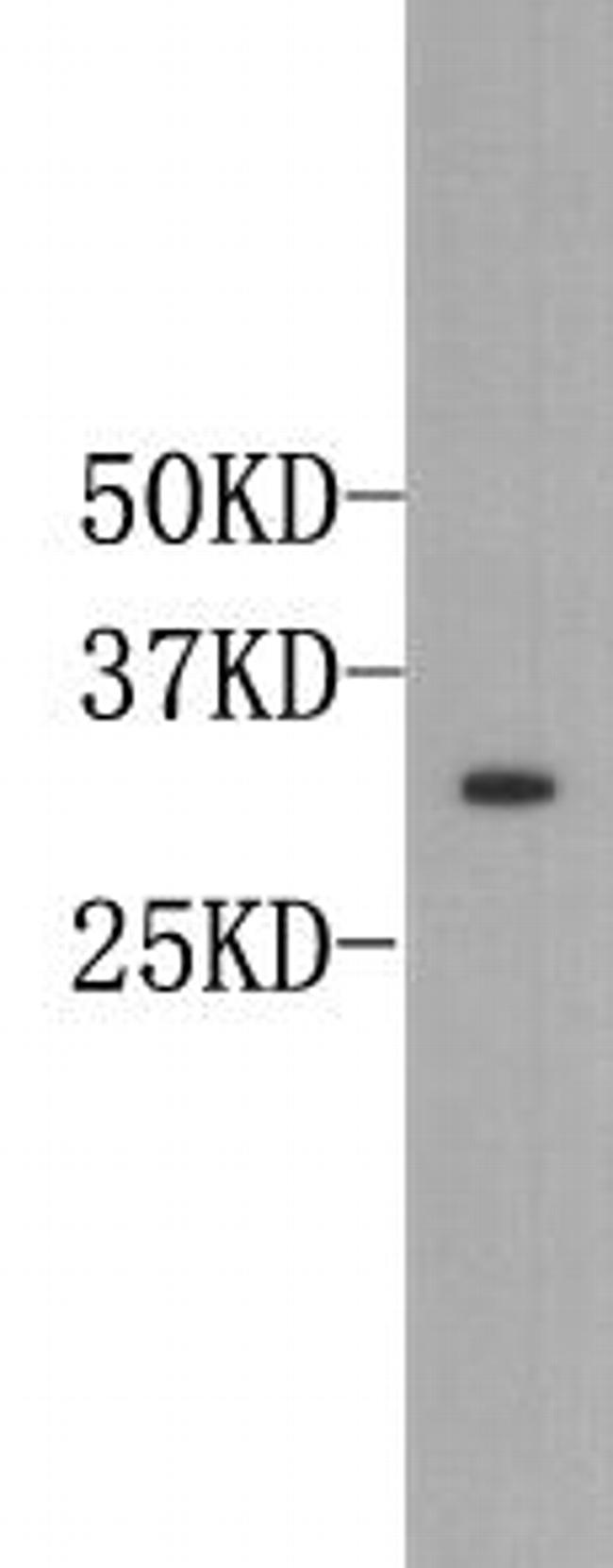 Osteopontin Antibody in Western Blot (WB)