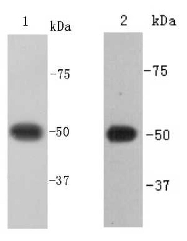 Beta III Tubulin Antibody in Western Blot (WB)