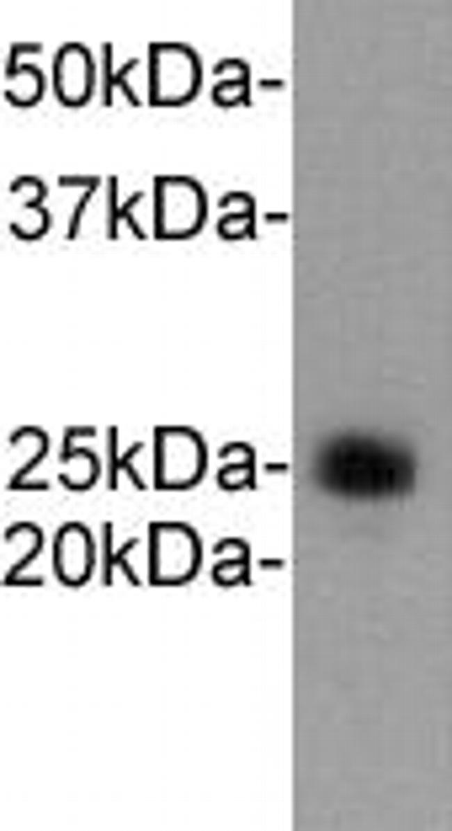 Ly-6G Antibody in Western Blot (WB)