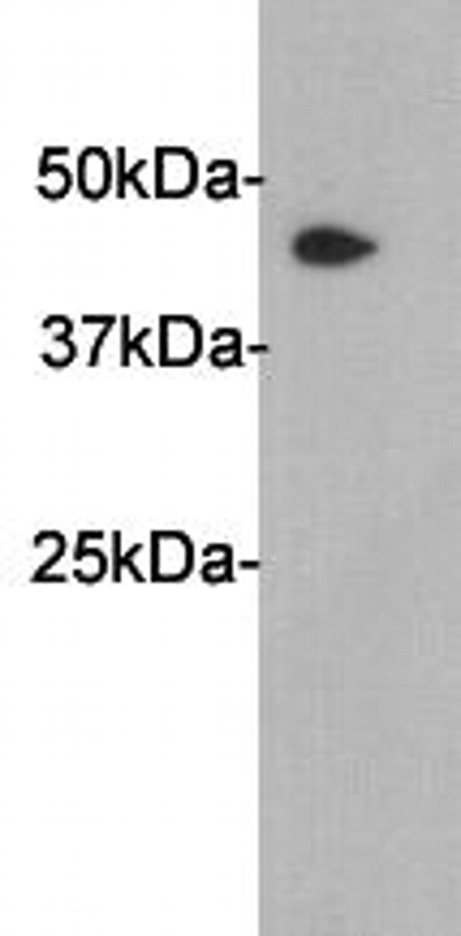 SERPINA5 Antibody in Western Blot (WB)