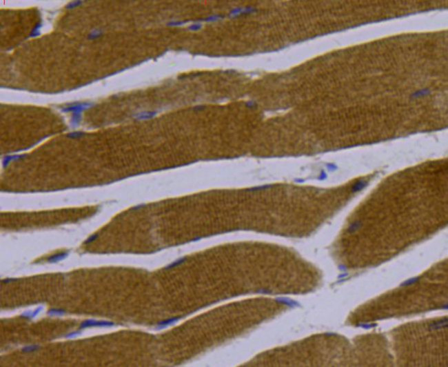 LDHA Antibody in Immunohistochemistry (Paraffin) (IHC (P))