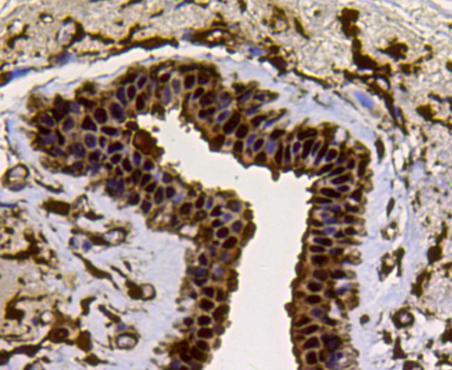 LDHA Antibody in Immunohistochemistry (Paraffin) (IHC (P))