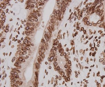 Lamin B2 Antibody in Immunohistochemistry (Paraffin) (IHC (P))