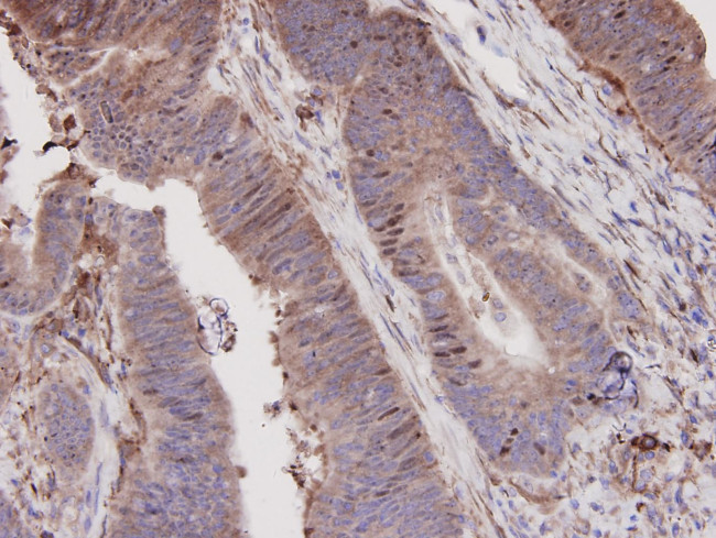 N-cadherin Antibody in Immunohistochemistry (Paraffin) (IHC (P))