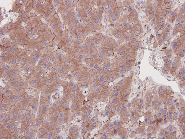 N-cadherin Antibody in Immunohistochemistry (Paraffin) (IHC (P))