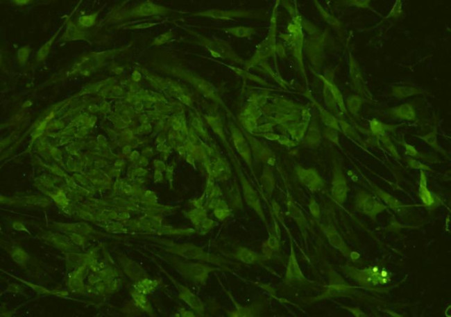 CD34 Antibody in Immunocytochemistry (ICC/IF)