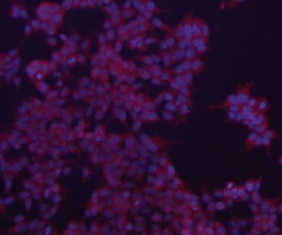 Bax Antibody in Immunocytochemistry (ICC/IF)