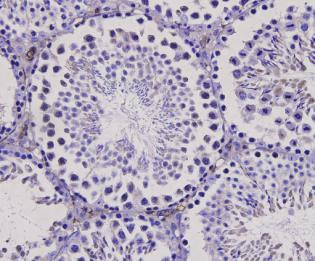 Bax Antibody in Immunohistochemistry (Paraffin) (IHC (P))