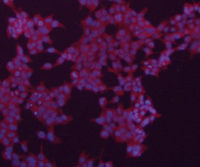 Alpha-Smooth Muscle Actin Antibody in Immunocytochemistry (ICC/IF)