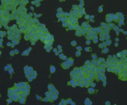 Alpha-Smooth Muscle Actin Antibody in Immunocytochemistry (ICC/IF)